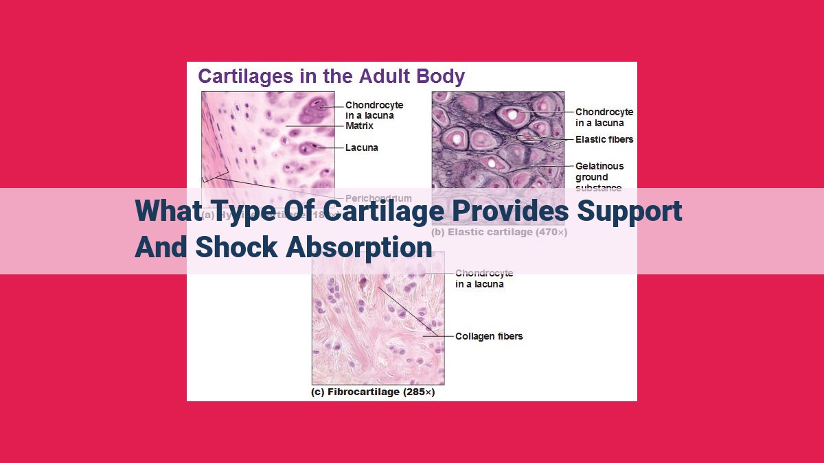 what type of cartilage provides support and shock absorption