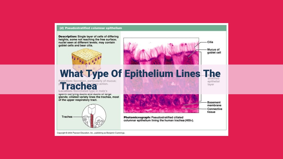 what type of epithelium lines the trachea